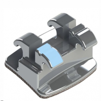 .REPOSICAO ROTH STANDARD 0,022´´ - INCISAL CENTRAL SUPERIOR ESQUERDO - 10.10.201 - MORELLI